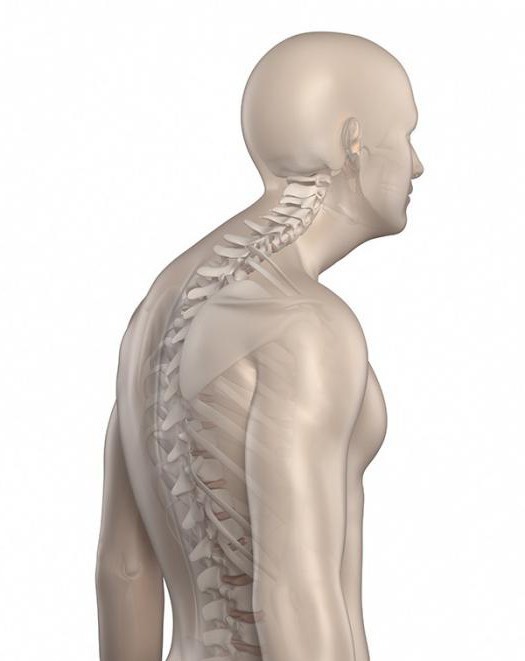 кифотическая deformação da coluna vertebral