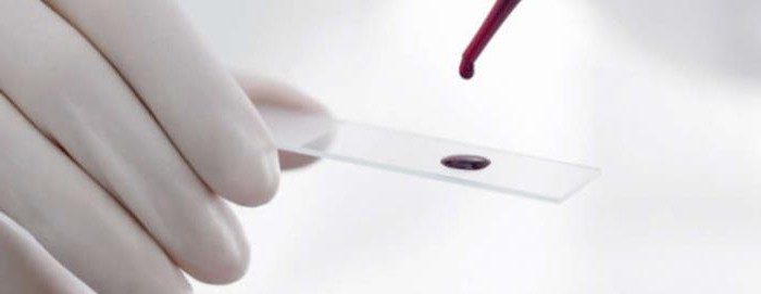 生物化学分析的血液记录Alt AST