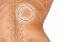 Co to jest guz na plecach w pobliżu kręgosłupa i jak ją leczyć?