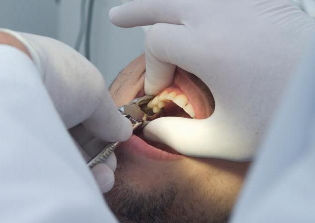 herausgezogenen zahn geschwollen