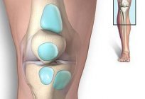Suprapatellar bursitisの膝:症状と治療