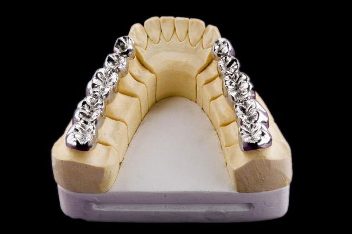 metal coroas de dentes