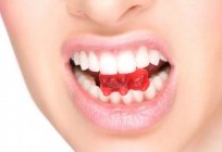 塑料冠上的前牙齿：指示、评论，照片